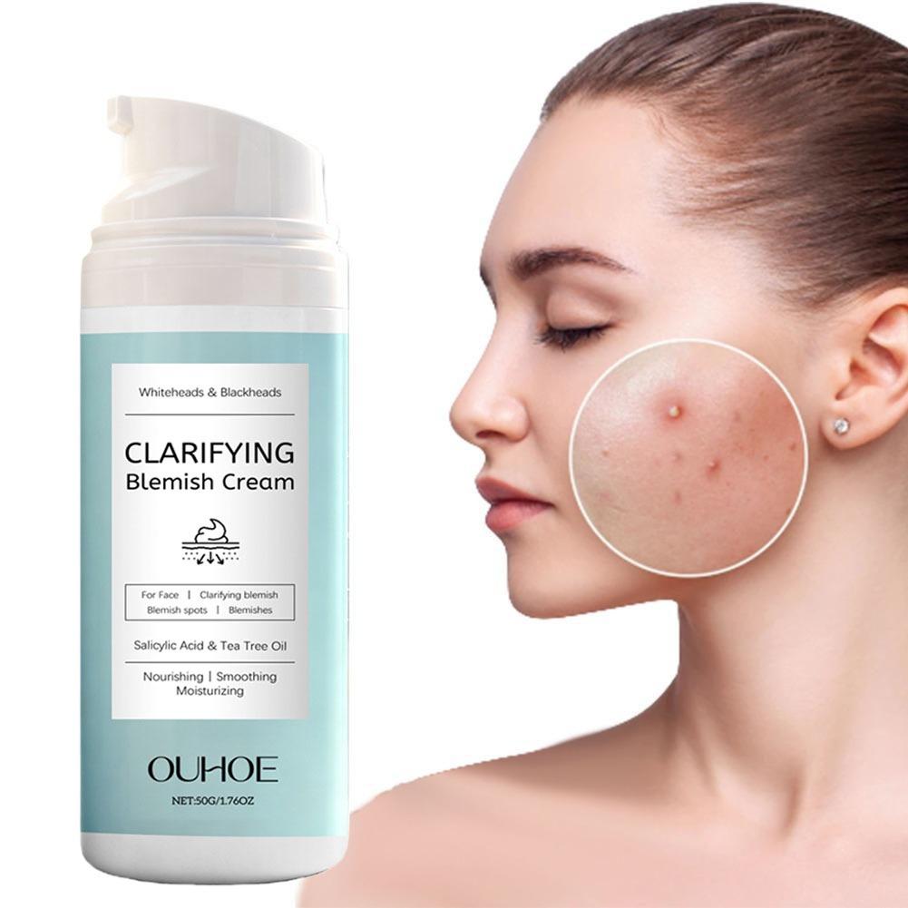 Salicylic Acid Blackhead Remover - Crème anti-acné à l'acide salicylique, nourrissante,