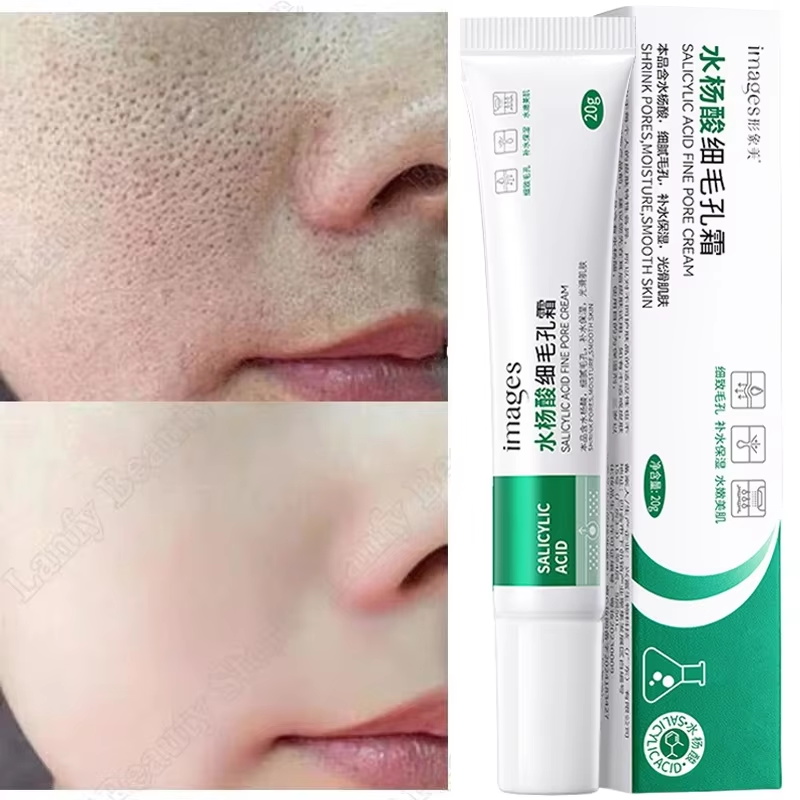 Crème Nettoyante pour les Pore - Salicylic Acid Blackhead Remover avis et prix